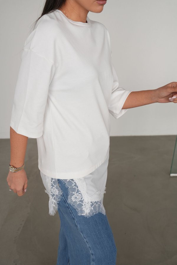 Etek Ucu Dantelli Asimetrik Kesim Elbise